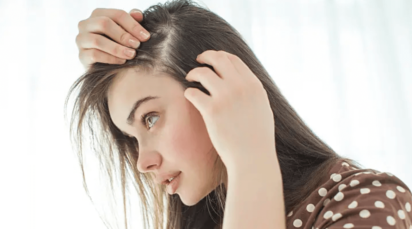 Frauen Haarausfall