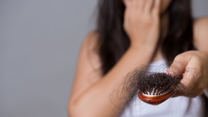 Hormonell bedingter Haarausfall